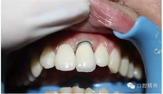 QQ圖片20150730112159.png QQ圖片20150730112159.png