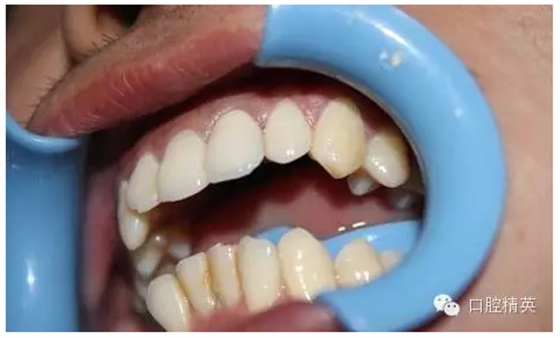 QQ圖片20150730113258.png QQ圖片20150730113258.png