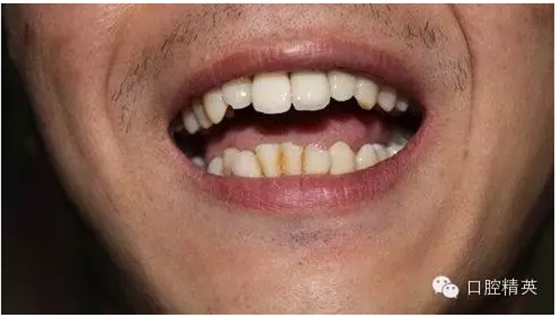 QQ圖片20150730113322.png QQ圖片20150730113322.png