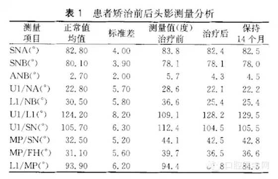 5.webp.jpg 5.webp.jpg