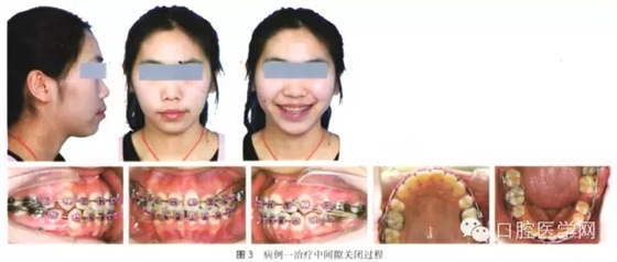 8.webp.jpg 8.webp.jpg