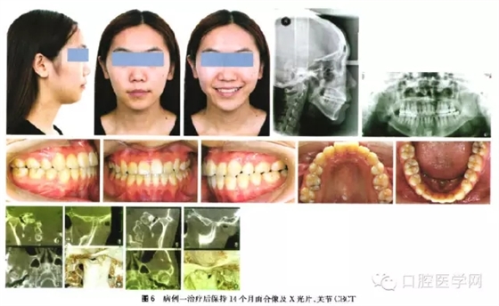 11.webp.jpg 11.webp.jpg