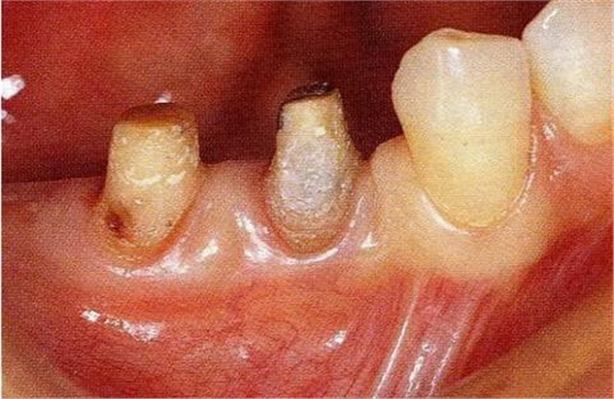 360截圖20170120114019791.jpg 360截圖20170120114019791.jpg