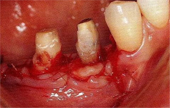 360截圖20170120114028262.jpg 360截圖20170120114028262.jpg