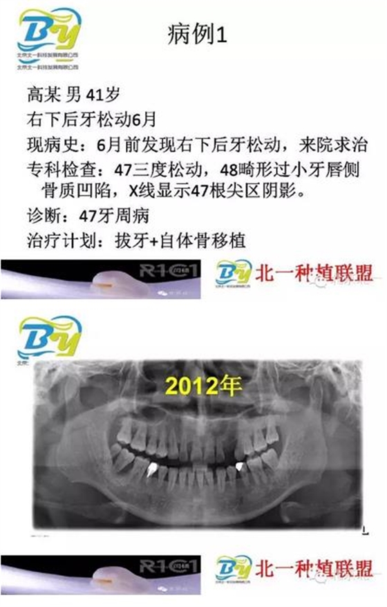 360截圖20170124112543496.jpg 360截圖20170124112543496.jpg