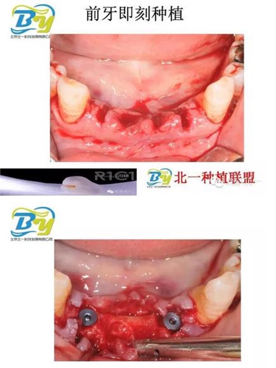 360截圖20170124112740959.jpg 360截圖20170124112740959.jpg