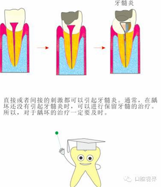 【愛牙科普知識300問】 “什么是融合牙、愈合牙和雙生牙？”
