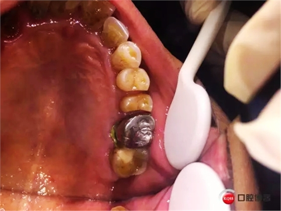 1.webp.jpg 1.webp.jpg