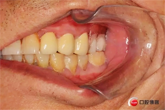 14.webp.jpg 14.webp.jpg