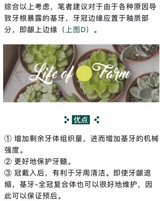 做全冠修復(fù)時基牙根面暴露，如何備牙？
