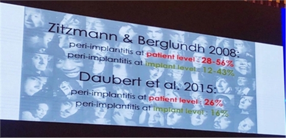 從風(fēng)險因素控制到及時有效治療，Dr. Laurence Adriaens深度解析種植體周圍炎的防治