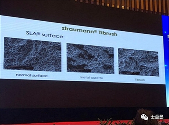 從風(fēng)險因素控制到及時有效治療，Dr. Laurence Adriaens深度解析種植體周圍炎的防治
