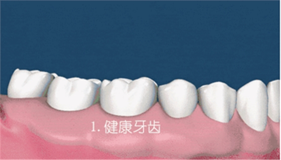 牙齦萎縮怎么辦？