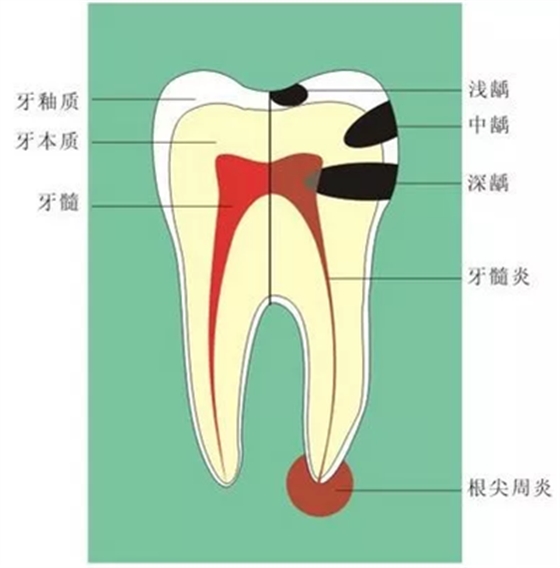 牙齦萎縮怎么辦？