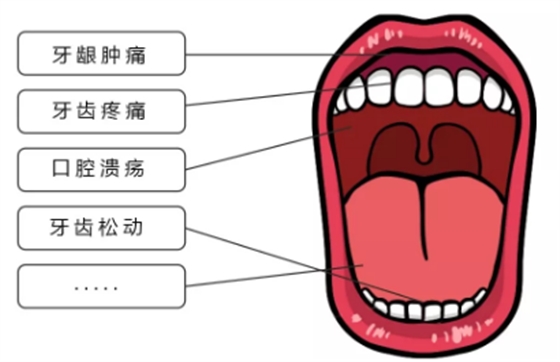 疫情期宅在家，牙齒出問(wèn)題怎么辦？
