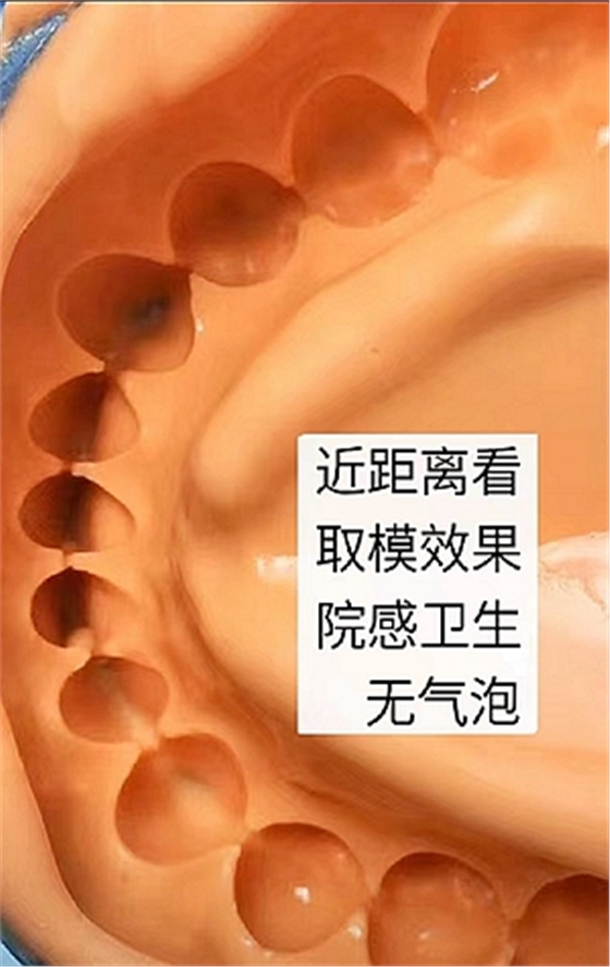 ?？抵Z德藻酸鹽印模材料