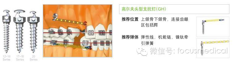 QQ圖片20150712111306.png QQ圖片20150712111306.png