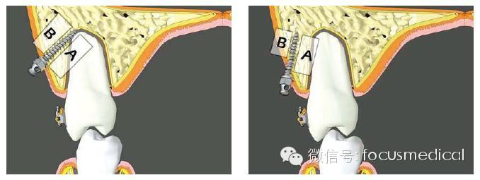 QQ圖片20150712111445.png QQ圖片20150712111445.png