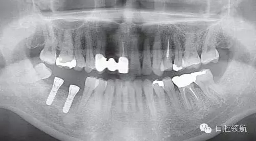 640.webp (1).jpg 640.webp (1).jpg