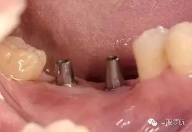 640.webp (4).jpg 640.webp (4).jpg