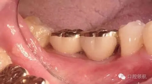 640.webp (6).jpg 640.webp (6).jpg