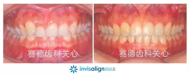 640.webp (2).jpg 640.webp (2).jpg