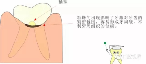 【愛牙科普知識(shí)300問】 “什么是融合牙、愈合牙和雙生牙？”