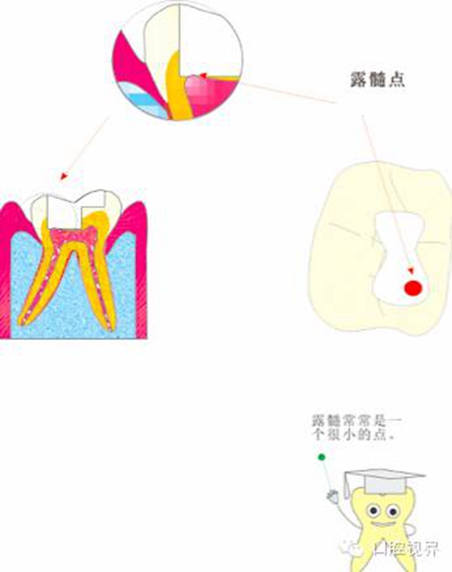 【愛牙科普知識(shí)300問】 “什么是融合牙、愈合牙和雙生牙？”