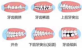 關于牙齒矯正，你想知道的都在這！