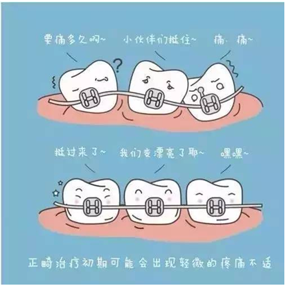 關于牙齒矯正，你想知道的都在這！