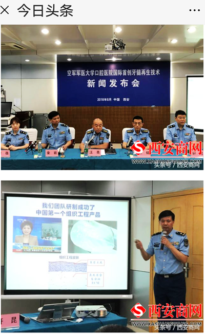 空軍軍醫(yī)大學口腔醫(yī)院首創(chuàng)牙髓再生術 空軍軍醫(yī)大學口腔醫(yī)院首創(chuàng)牙髓再生術